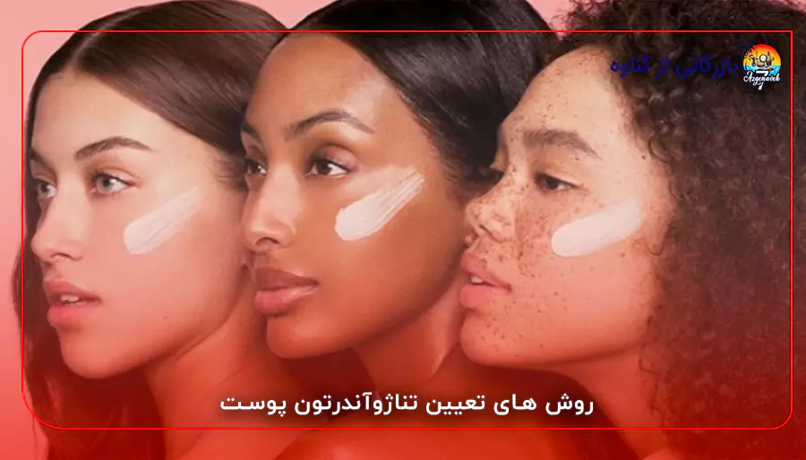 روش های تعیین تناژوآندرتون پوست